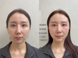 -素美医疗美容·西南眼鼻整形·修复基地