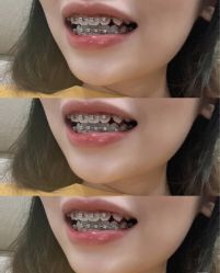 -安徽合肥韩美整形外科医院