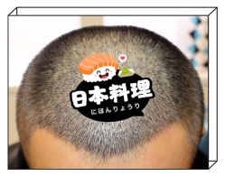 -大麦微针植发全国连锁