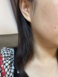 体验后-广州美莱医疗美容医院