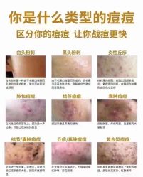 -+MS卓美丝专业祛痘·皮肤管理中心