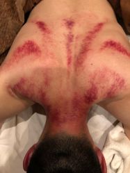 点击看大图 -升艾堂亚健康调理中心