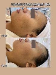 -美肤盾祛痘·问题肌头疗管理中心