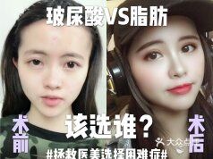 面部填充,到底选玻尿酸还是自体脂肪?
