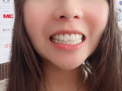 -极光口腔·矫正种植修复(锦江店)