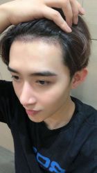 点击看大图 -大麦微针植发丨全国连锁