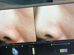 -苑苑vbeauty科技美容SPA
