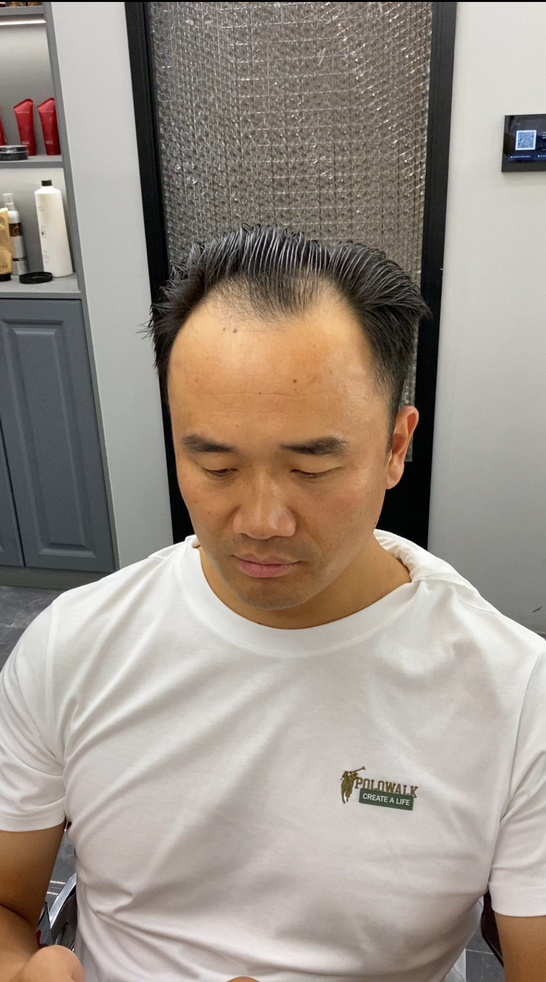 所有脱发的小哥看过来