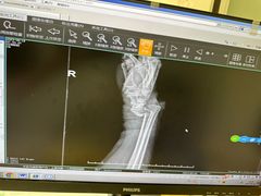 -上海市第一人民医院(松江南部)