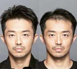 -发饰美男士增发补发假发定制店