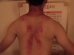 -康正盲人按摩养生馆(君御花园店)