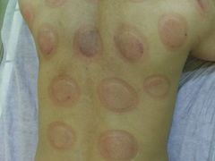 -初心正骨艾灸养生馆