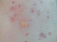 -苏州大学附属第二医院(三香院区)