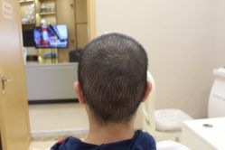 -大麦微针植发丨全国连锁