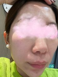 体验后-澳尔颜选医疗美容