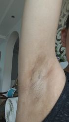 体验后-上海玫瑰医疗美容医院