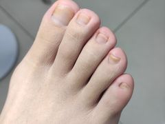 -世龙世家甲沟炎·灰指甲·嵌甲矫正·修脚(武侯区双楠店)