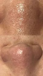 -SKIN79皮肤管理中心