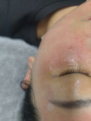 -长沙雅美医疗美容医院