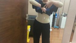 体验后-洁铭新加坡医美