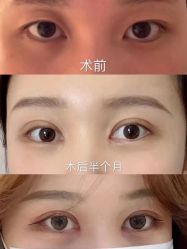 -深圳鹏爱悦心医疗美容医院
