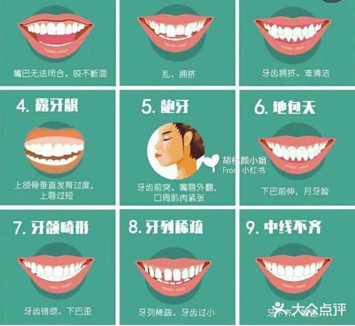 炸了！暑期矫牙好时节？   我是一位22岁的宝宝