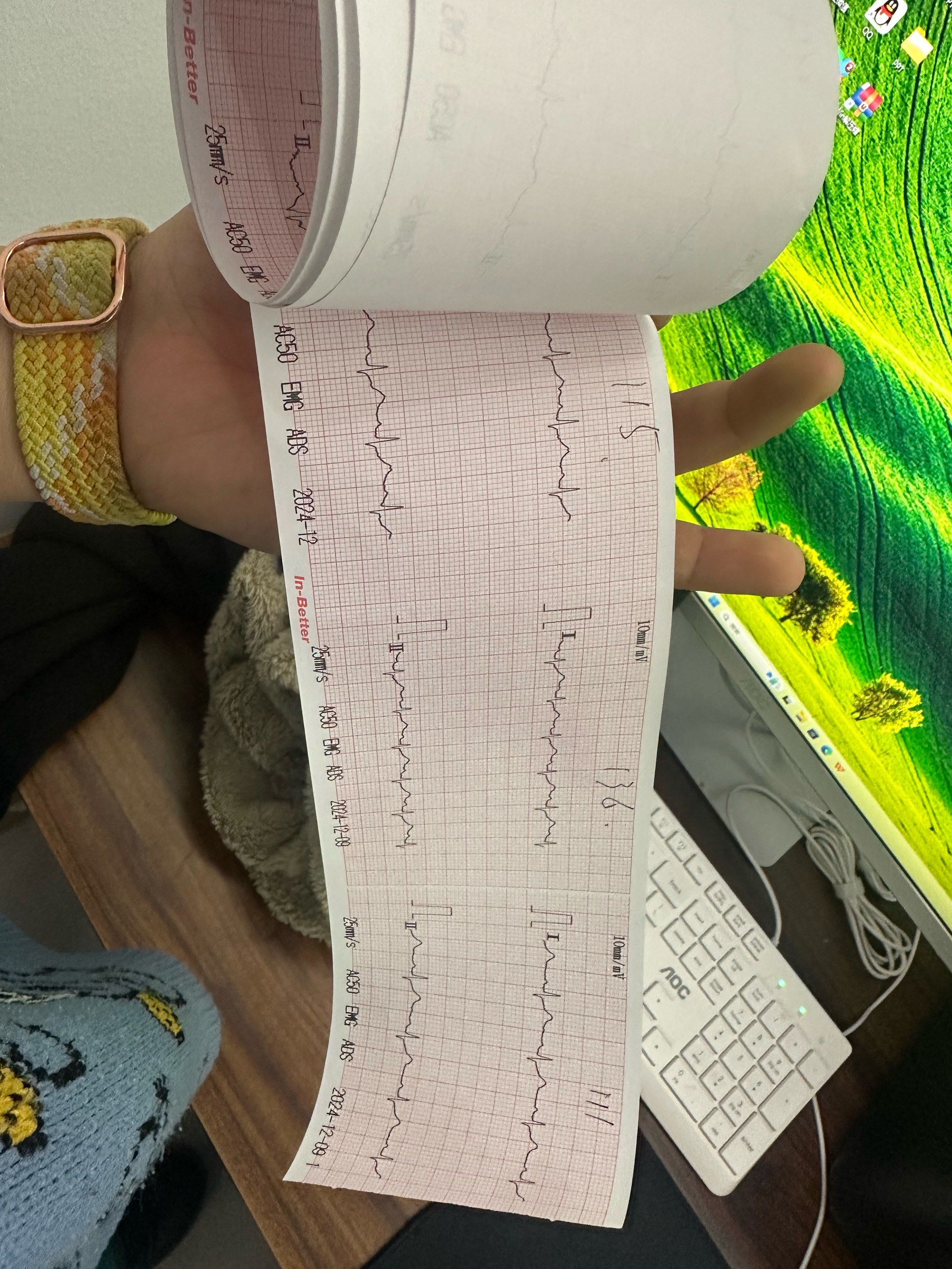 用机器测一下心率