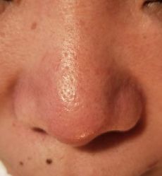 -SKIN MOLY魔力之肌皮肤管理中心