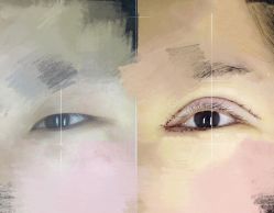 -鑫元辰医疗美容整形