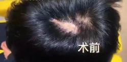 -熙朵美学植发连锁