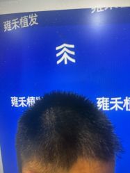 -雍禾植发全国连锁