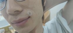 -广州美莱医疗美容医院