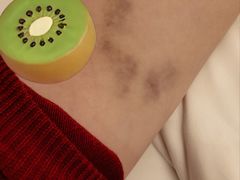 -江南大学附属医院(北院区)