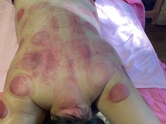 -沈师傅盲人按摩工作室(密三小区店)