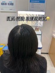 -雍禾植发全国连锁