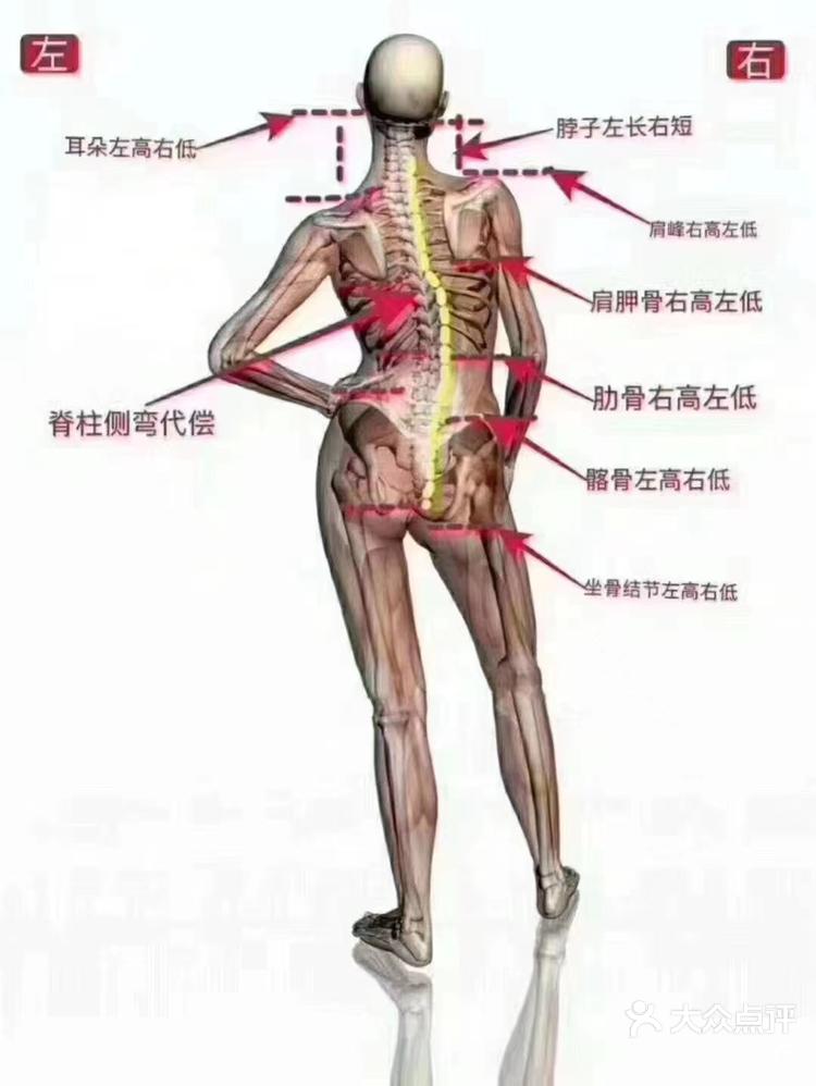 9797三七步 这样的站姿,会引起长-大众点评