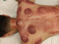 -太乙盲人推拿足疗艾灸连锁(晴川店)