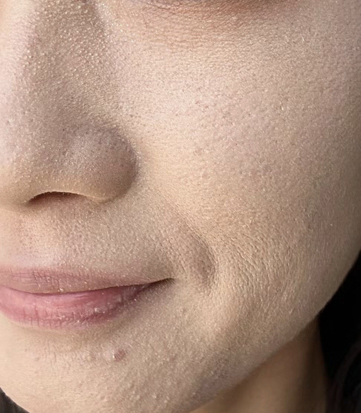 冬天皮肤状态!大干皮,大颗粒!难受糟心!