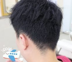-大麦微针植发全国连锁