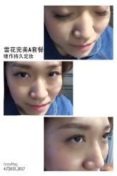 睫毛嫁接-光SPA科技美肤