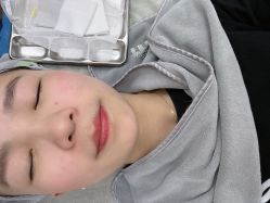 体验后-杭州奥拉克医疗美容门诊部