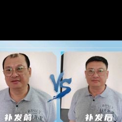 -极客侠男士假发定制补发