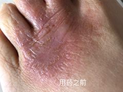 -中国人民解放军总医院