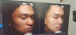 -丽美妍医疗美容·皮秒·立体分层抗衰