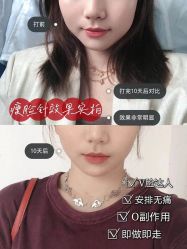 -Yestar艺星医疗美容医院