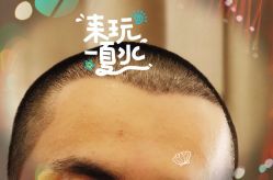 -大麦微针植发全国连锁