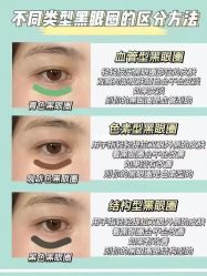 -广州健丽·去眼袋医疗美容机构