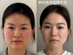-上海伊莱美医疗美容医院