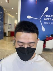 体验后-大麦微针植发全国连锁