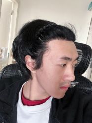 点击看大图 -大麦微针植发全国连锁